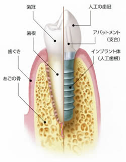 構造