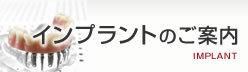 インプラントのご案内