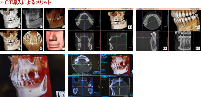 CT導入によるメリット